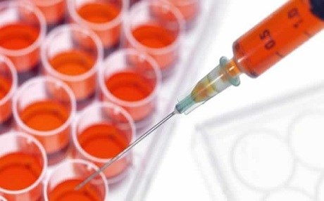 Kürdistan’da kök hücre nakli