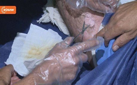 پێشمەرگە كیمیاباران دەكرێ و ماسك بۆ سوپای عێراق دەنێرن