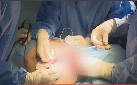 BI DÎMEN – Ji bo pêşmergeyekî neştergeriyek dîrokî