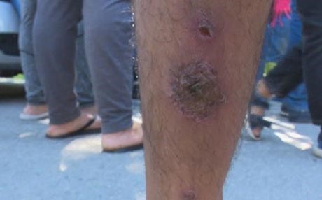 YÛNANÎSTAN – Penaberên kurd nexweşiyên laşî û derûnî digrin