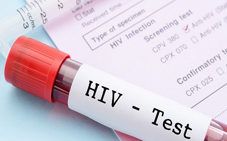 Türkiye’de AIDS patlaması!