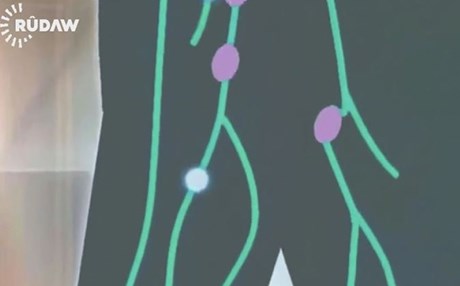 ئۆرۆگوای پێکوتەی ‌HPV دەخاتە خشتەی کوتانی خانمان