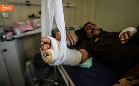 FOTO/Kerkük - Yaralılar tedavi altında