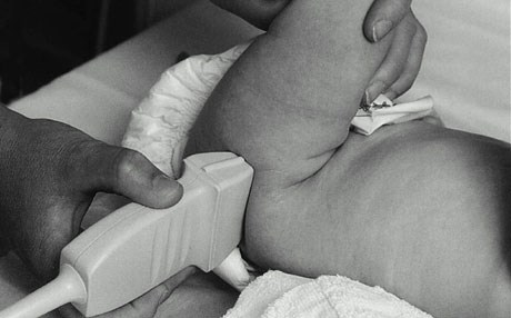 چ كاتێك سۆنەر بۆ سمتی منداڵ بكەین؟