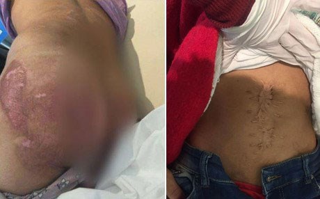 كەس منداڵە ئەشكەنجەدراوەكانی ئاخجەلەر لەخۆناگرێت