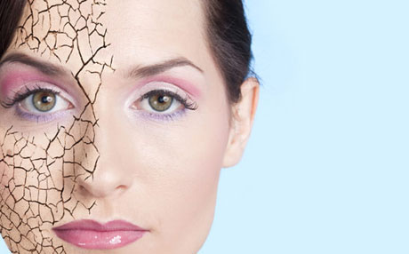 Çermê we zivistanê zûha bibe xwe zêde neşûn