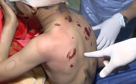 IŞİD’den kimyasal saldırı