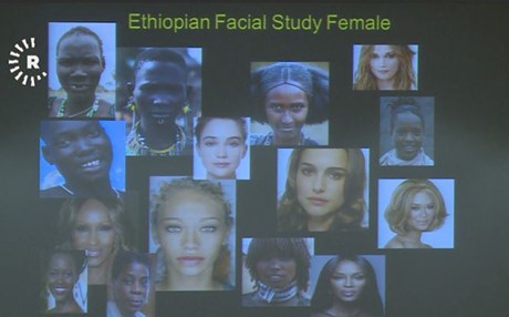 لە سلێمانی دووەمین کۆنفرانسی نێودەوڵەتی پزیشکانی نەشتەرگەری جوانکاری و رێککاری بەڕێوەچوو