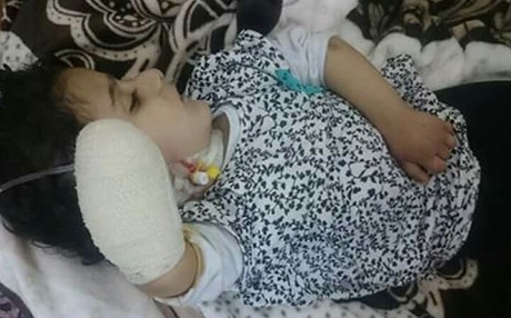 وردەکاریی نەخۆشکەوتن و بڕینەوەی دەستی سەنا