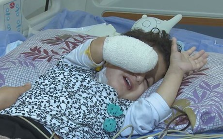 DUHOK – Ji ber derziya xelet destê keçika 2 salî hate birîn