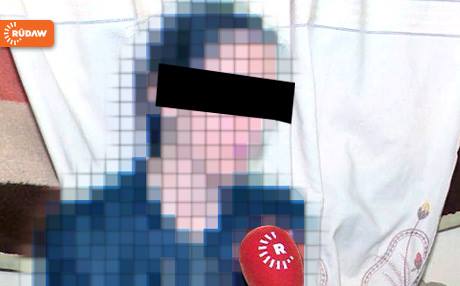 Raporta bijîşkî li ser keça 16 salî