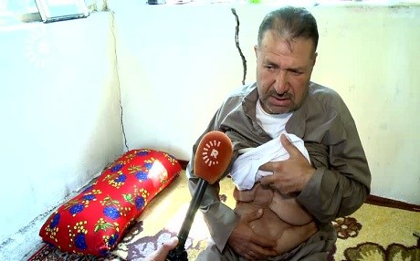 Koçberî xemek e, lê nexweşiya di koçberiyê de hezar xem!