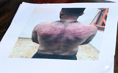 Çekdarên Heşda Şeibî îşkence li xortekî mesîhî kirin