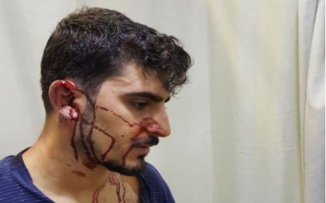 Urfa’da öğretmene sokak ortasında dayak!