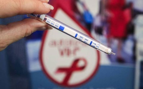 Li Ewropayê AIDS "bi awayekî tirsnak" zêde bûye