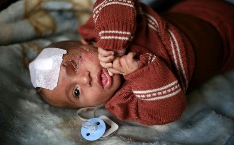 Medical evacuation of Syria's Eastern Ghouta begins: ICRC