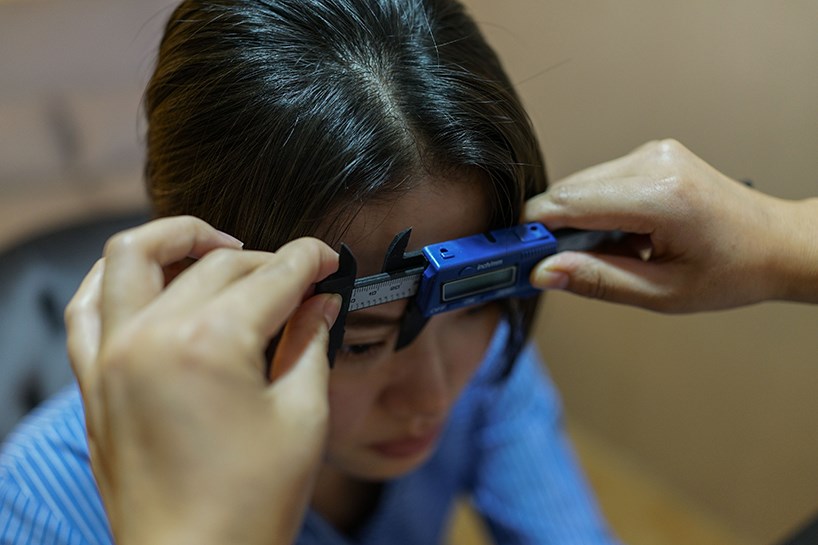 Fotoğraflarla Çinli kadınların estetik operasyonları