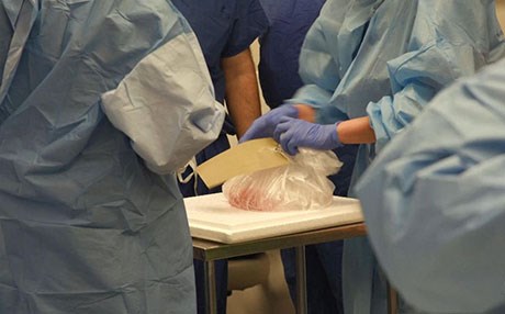 یەکەم نەشتەرگەری چاندنی تەواوی چووک و گون ئەنجامدرا