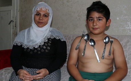 Batmanlı aile şokta: Çocukları ‘mıknatıs’ çıktı