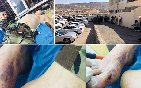 DUHOK – Pêşmergeyekî ji ber pêvedana mar jiyana xwe ji dest da