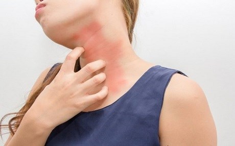 6 sedemên çêbûna kizirokên çermê