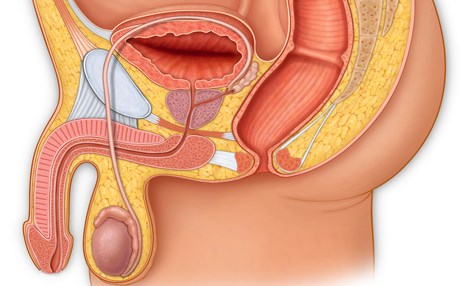 چیرۆکی گەنجە چووک شکاوەکە!