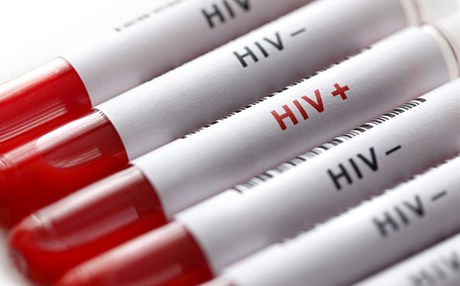 دووەم نەخۆشی تووشبووی ئایدز لە بەریتانیا چارەسەرکرا