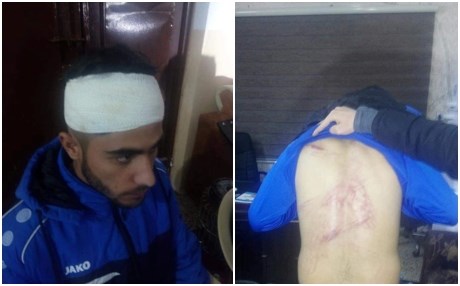 یانەی ئاکرێ: پۆلیس و هاندەرانی دهۆک برینداریان کردین