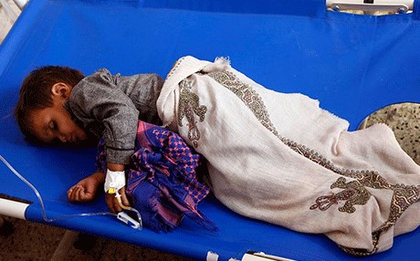 Yemen'de kolera salgını nedeniyle olağanüstü hal ilan edildi
