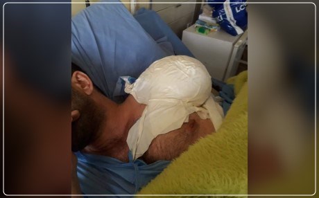 Iraqi man loses arm after prison torture: HRW
