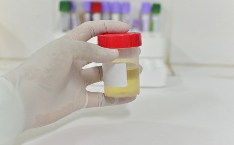 پشکنینێکی نوێی میز دەستنیشانی شێرپەنجەی پرۆستات دەکات