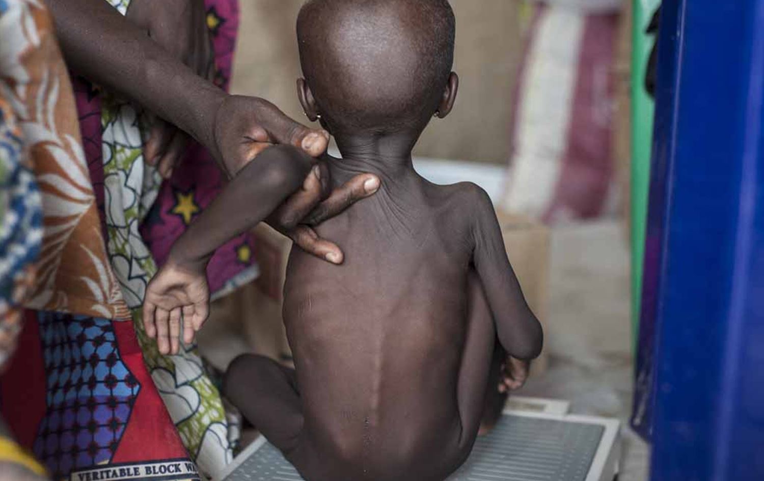 لە ساڵی 2017 نزیکەی 6.3 ملیۆن منداڵ گیانیان لەدەستداوە