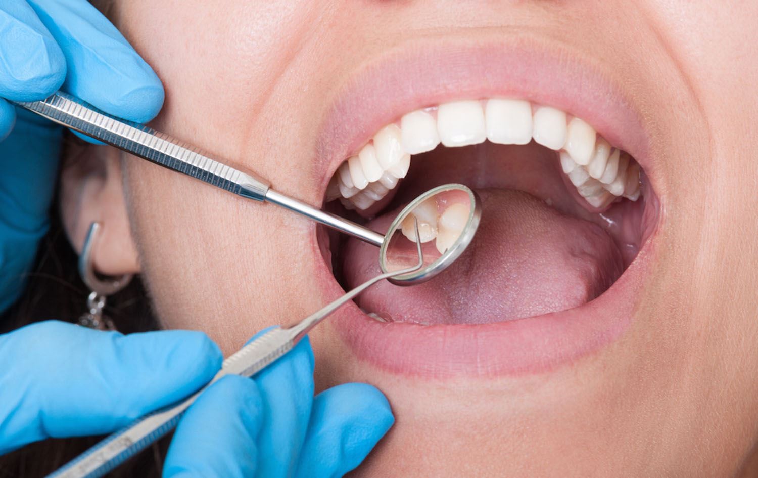 پاک رانەگرتنی دەم و ددان مەترسیی لەسەر مێشک دروستدەکات