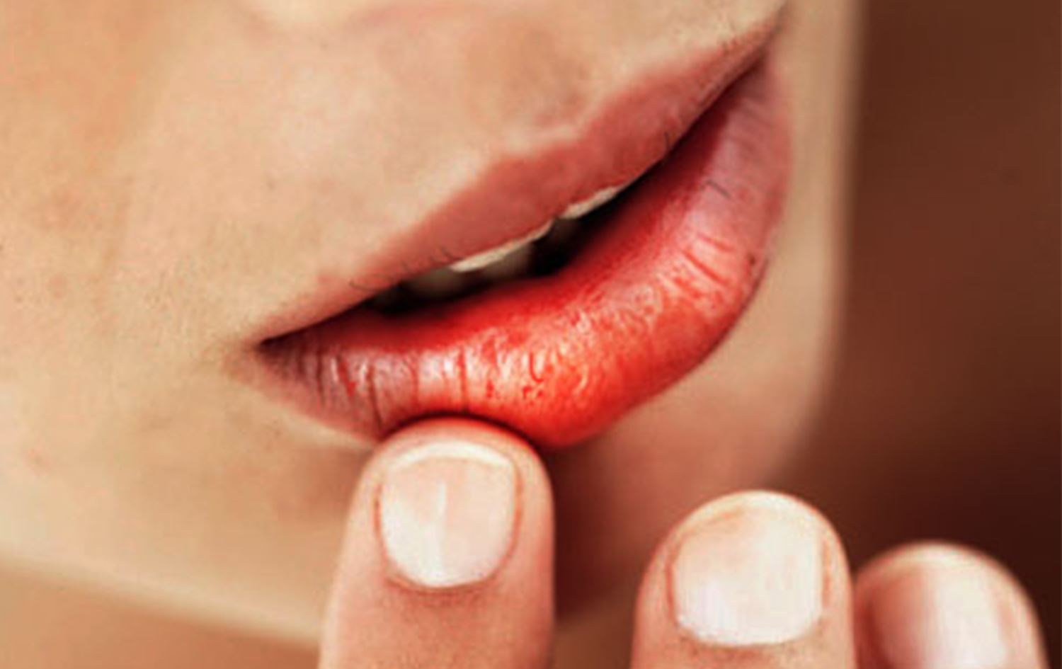 بەم رێگەیانە چارەسەری گرفتی وشکی دەم بکە