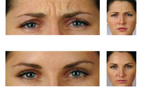 جیقنەی باڵندە بۆ شاردنەوەی نیشانەکانی پیری