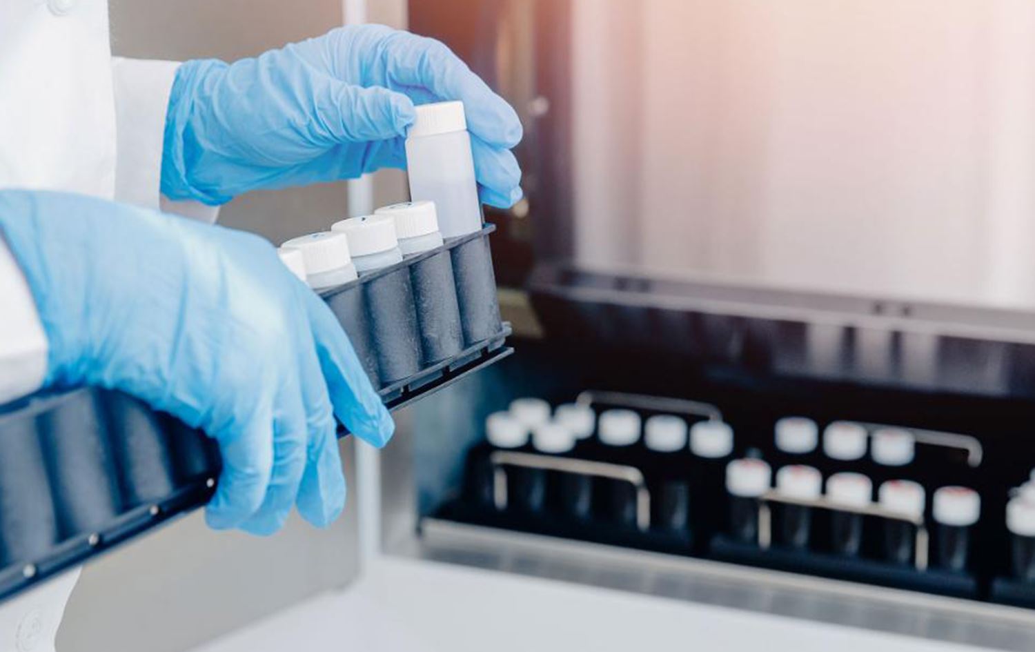 لە بەریتانیا داوادەکرێت بەخشینی سپێرم دوای مردن رێگەپێدراوبێت