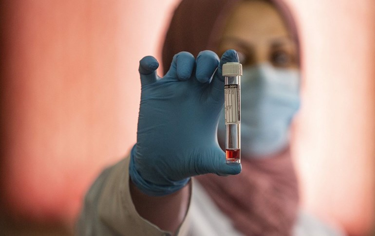 A member of the COVID-19 Crisis Cell holds a vial at Basra university, southern Iraq, April 6, 2020. Photo: Hussein Faleh / AFP 