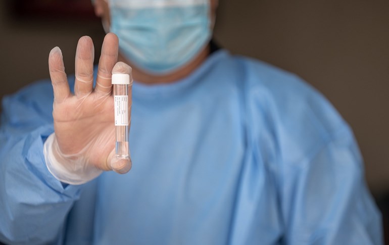 A health worker at Erbil Central Hospital holds up a vial as he tests for the presence of COVID-19. Photo: Bilind T. Abdullah/Rudaw