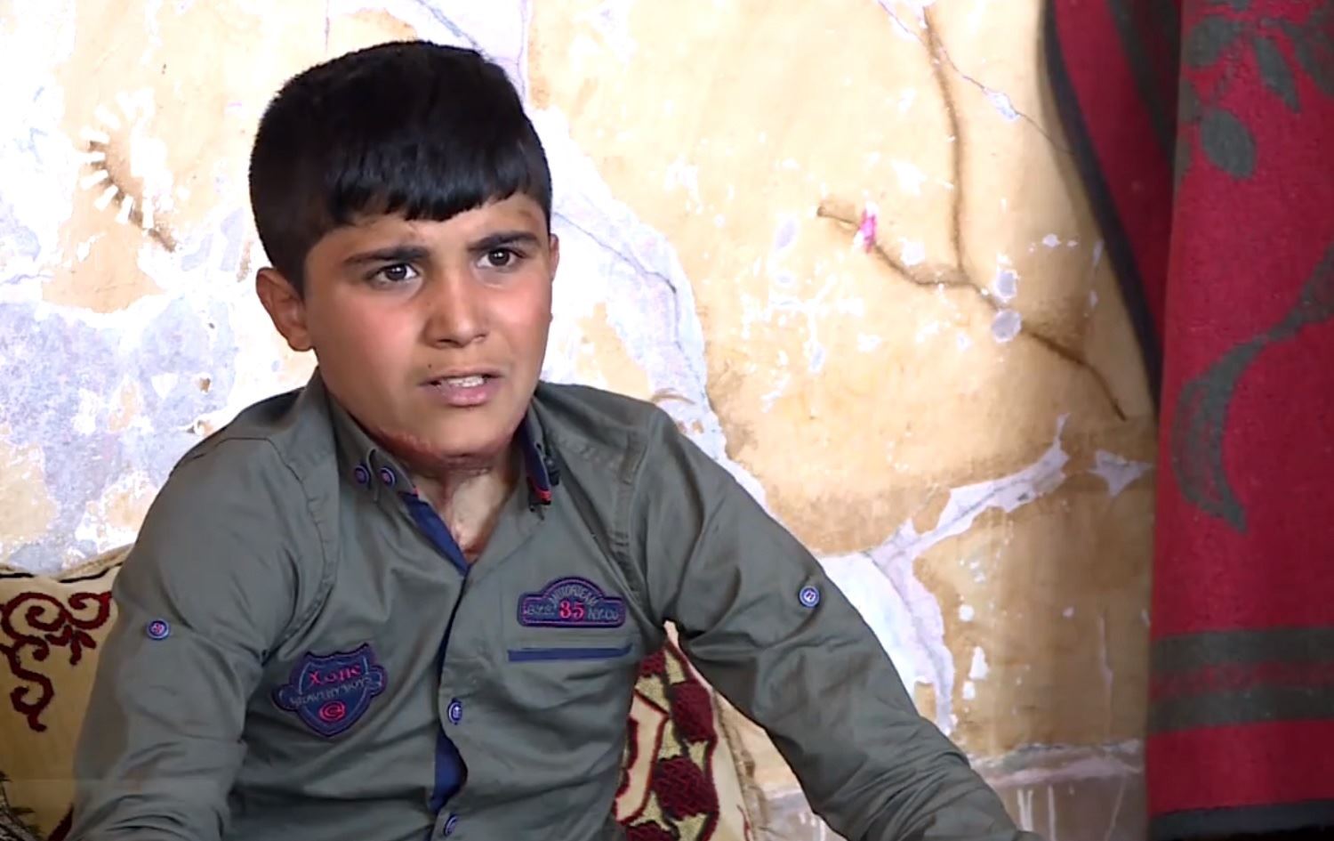 Rewşa Mihemedê Serê Kaniyê xirab e û alîkariyê dixwaze