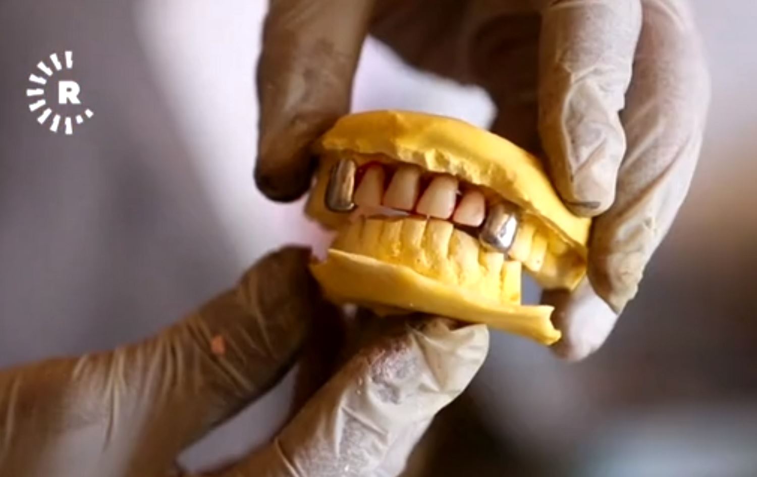 Di çadira xwe ya biçûk de diranên zêr û zîv çê dike