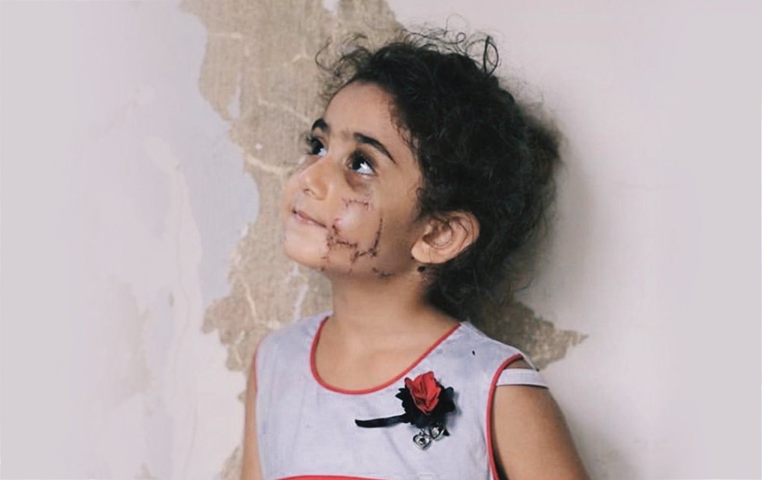 شوێنەواری برینێکی گەورە لەسەر کوڵمێکی ناسکۆڵە