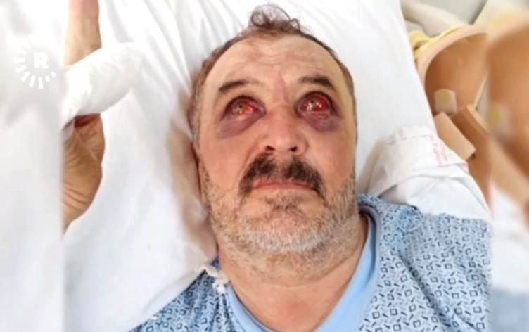 Af Örgütü: İşkence iddiaları bağımsız şekilde soruşturulmalı