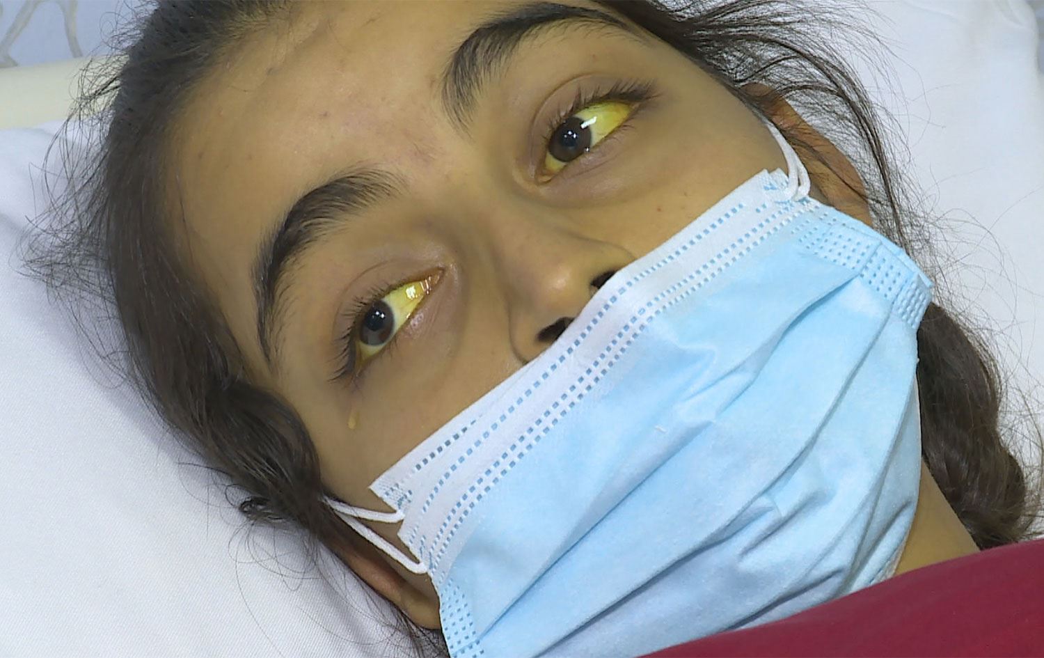 ئازاری نەخۆشیی پەککەوتنی جگەر فرمێسک لە چاوی کچێکی 16 ساڵ دێنێت