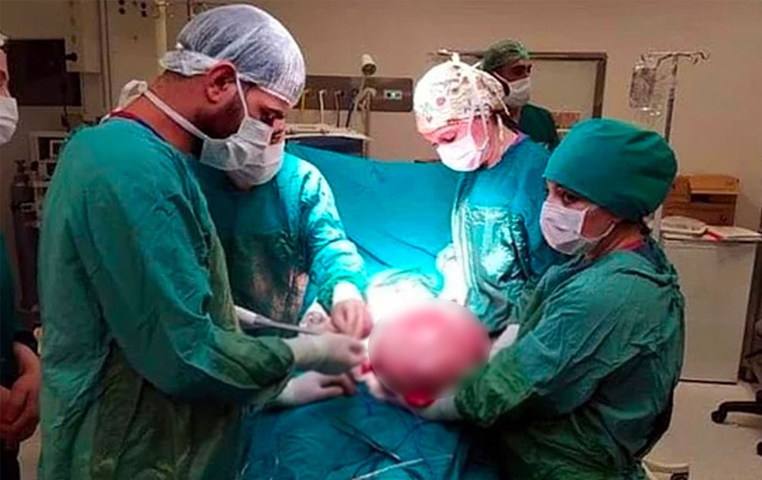 Van'da bir kadının karnından 9 kilo 800 gram kitle çıkarıldı