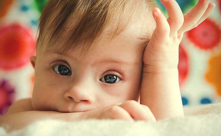 لە ئەوروپا لەدایکبوونی کۆرپەی تووشبووی داون کەمیکردووە