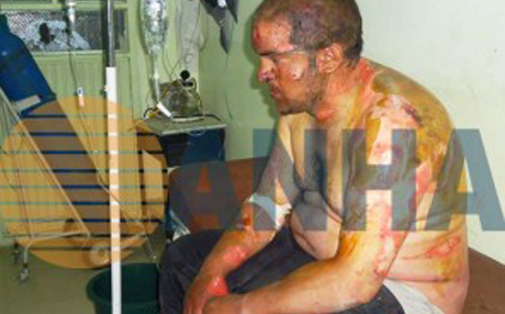 ANHA: Artêşa Azad welatiyek kurd şewitand