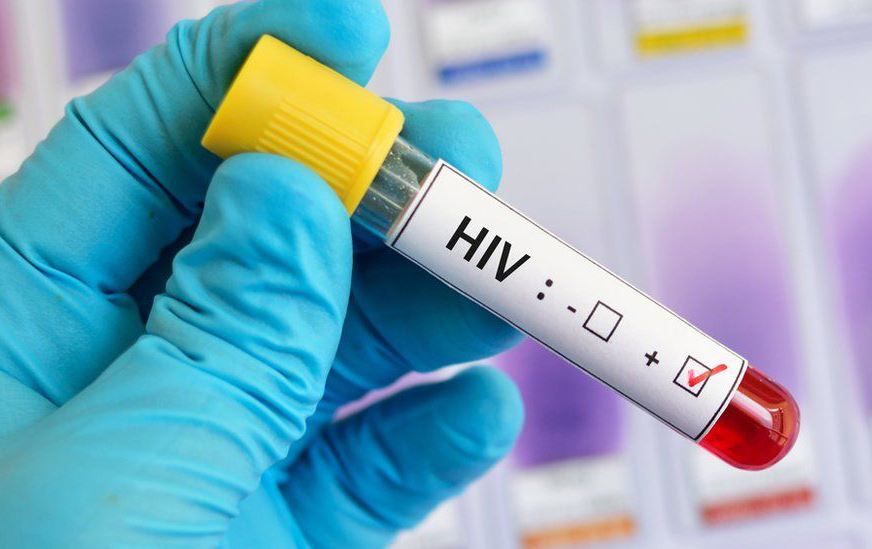 لە کۆنگۆ، بەشێکی هەڵگرانی ڤایرۆسی HIV  بەبێ وەرگرتنی دەرمان چاکبوونەتەوە
