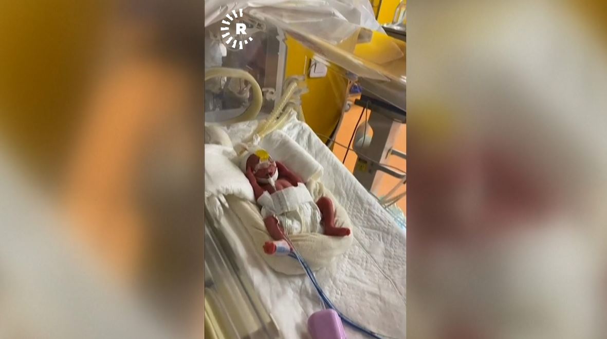 ژنێکی تەمەن 25 ساڵ بەسکێک نۆ منداڵی دەبێت