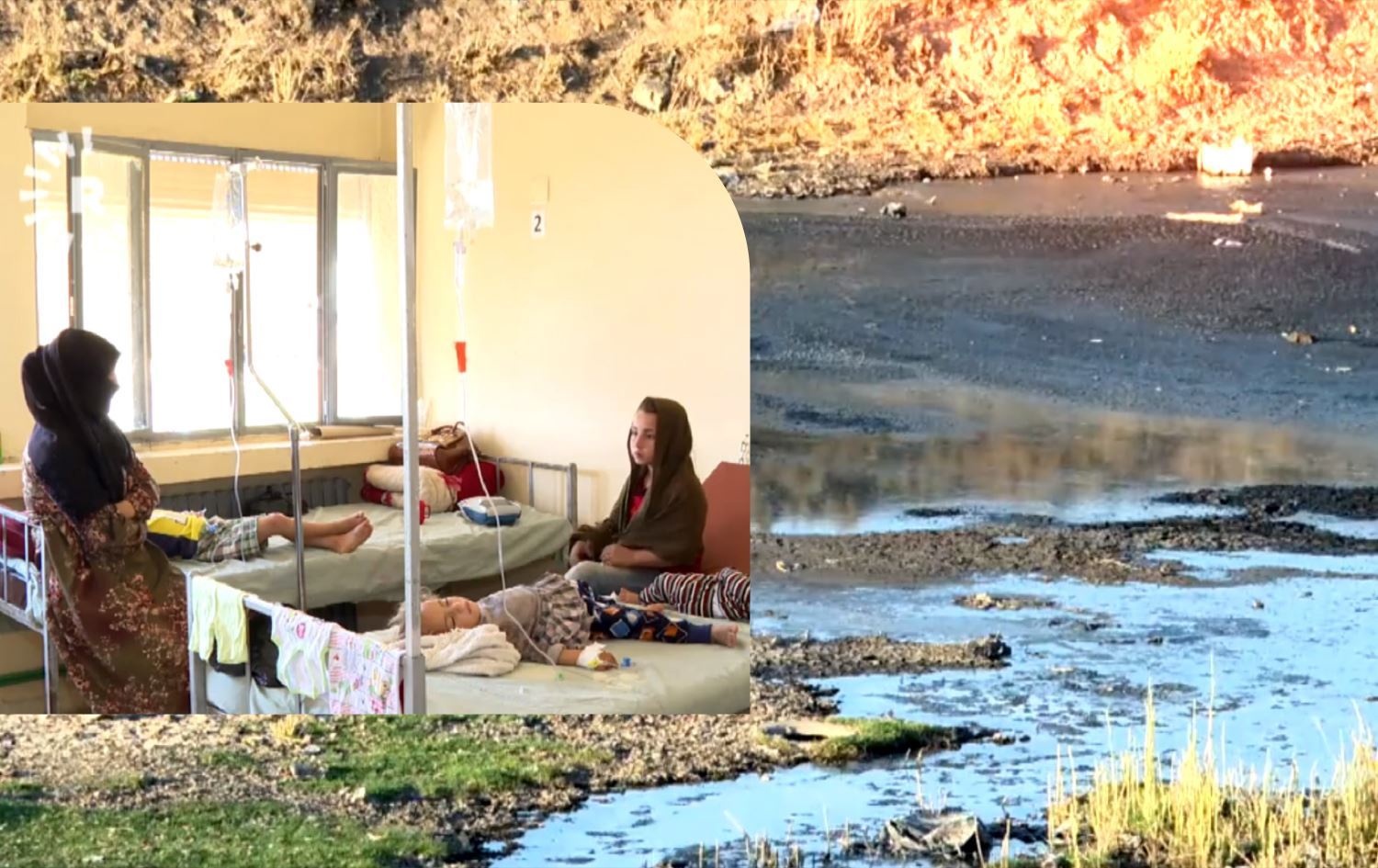 Li Rojava ji ber ava qirêj nexweşî di nav zarokan de belav dibin