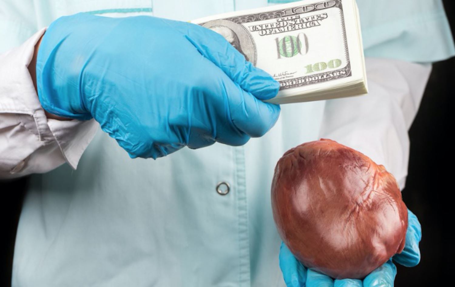 رێکخراوی جەستەبەخشان: لە کوردستان بازرگانی بە گون، جگەر و گلێنەی چاو دەکرێت